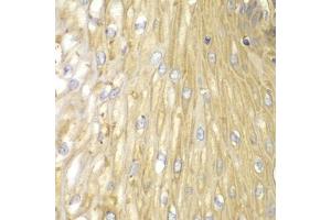 Immunohistochemistry of paraffin-embedded human esophagus using PPP2R2A antibody (ABIN5971211) at dilution of 1/100 (40x lens).