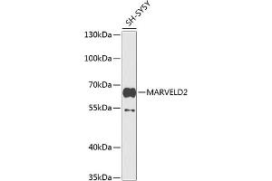 Western blot analysis of extracts of SH-SY5Y cells, using M antibody (ABIN6133958, ABIN6143567, ABIN6143569 and ABIN6224825) at 1:1000 dilution. (Tricellulin antibody  (AA 200-300))