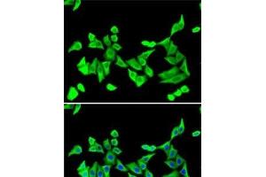 Immunofluorescence analysis of U2OS cells using PTH Polyclonal Antibody (PTH antibody)