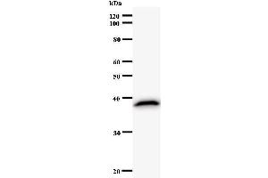 Western Blotting (WB) image for anti-Tax1 (Human T-Cell Leukemia Virus Type I) Binding Protein 1 (TAX1BP1) antibody (ABIN931085) (TAX1BP1 antibody)