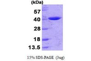 LACTB Protein (AA 20-377) (His tag)