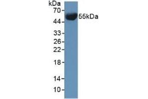 Detection of INV in Mouse Serum using Polyclonal Antibody to Involucrin (INV) (Involucrin antibody  (AA 301-460))