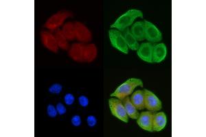 ABIN6258579 and ABIN6274824 staining Hela cells(45 min of heat-shock) by IF/ICC.