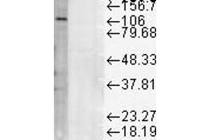 LAMP1 WB 1 in 1000 rat liver micosomes 20ug copy. (LAMP1 antibody)
