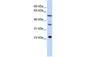 Western Blotting (WB) image for anti-Centromere Protein M (CENPM) antibody (ABIN2459009)