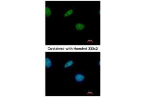 ICC/IF Image Immunofluorescence analysis of paraformaldehyde-fixed A549, using LXR beta, antibody at 1:500 dilution. (NR1H2 antibody  (N-Term))