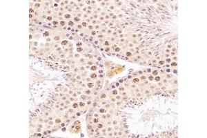 Immunohistochemistry (Paraffin-embedded Sections) (IHC (p)) image for anti-DMRT-Like Family A2 (DMRTA2) antibody (ABIN7073753)