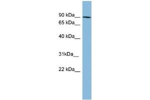 WB Suggested Anti-PRKCB1 Antibody Titration: 0. (Pkc beta 1 antibody  (N-Term))