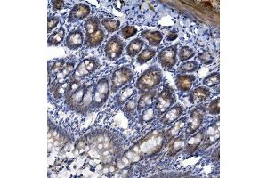 IHC analysis of TTK using anti-TTK antibody (ABIN7601844). (Mps1 antibody  (AA 487-821))