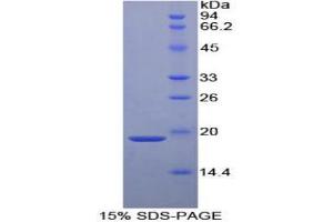 SDS-PAGE analysis of Human a2PI Protein. (alpha 2 Antiplasmin Protein)