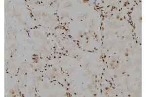 ABIN6274778 at 1/100 staining Human lung tissue by IHC-P. (RPL30 antibody  (C-Term))