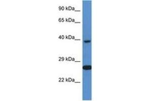 Image no. 1 for anti-X-Ray Repair Complementing Defective Repair in Chinese Hamster Cells 3 (XRCC3) (C-Term) antibody (ABIN6747307)