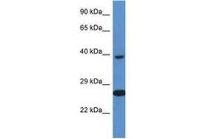 Image no. 1 for anti-X-Ray Repair Complementing Defective Repair in Chinese Hamster Cells 3 (XRCC3) (C-Term) antibody (ABIN6747307) (XRCC3 antibody  (C-Term))