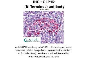 Image no. 1 for anti-Glucagon-Like Peptide 1 Receptor (GLP1R) (Extracellular Domain), (N-Term) antibody (ABIN1734727) (GLP1R antibody  (Extracellular Domain, N-Term))