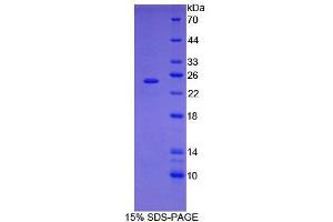 SDS-PAGE (SDS) image for Signal Transducer and Activator of Transcription 3 (Acute-Phase Response Factor) (STAT3) (AA 346-552) protein (His tag) (ABIN6238627) (STAT3 Protein (AA 346-552) (His tag))