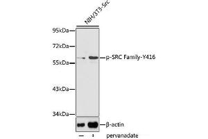 Western blot analysis of extracts of NIH/3T3-Src cells using Phospho-SRC Family(Y416) Polyclonal Antibody. (Src Family (pTyr416) antibody)