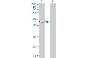 Western Blot analysis of SPHK1 expression in transfected 293T cell line by SPHK1 monoclonal antibody (M01), clone 1D6. (SPHK1 antibody  (AA 1-384))