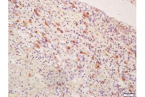 Formalin-fixed and paraffin embedded human placenta tissue labeled with Rabbit Anti-Inhibin Alpha Polyclonal Antibody, Unconjugated (ABIN1715125) at 1:200 followed by conjugation to the secondary antibody and DAB staining (Inhibin alpha antibody  (AA 281-366))
