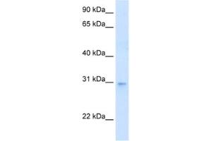Western Blotting (WB) image for anti-LIM Domain Binding 3 (LDB3) antibody (ABIN2462434)