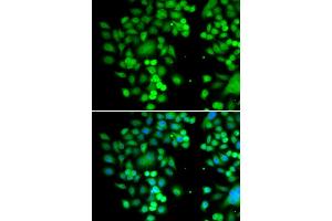 Immunofluorescence analysis of MCF7 cell using PHYHD1 antibody. (PHYHD1 antibody)