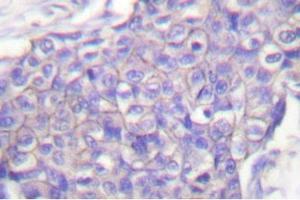 Image no. 2 for anti-CD40 (CD40) antibody (ABIN271944) (CD40 antibody)