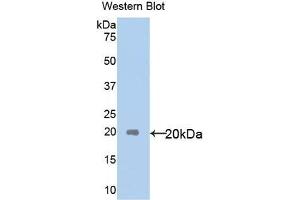 Detection of Recombinant IL18, Human using Polyclonal Antibody to Interleukin 18 (IL18) (IL-18 antibody  (AA 37-193))