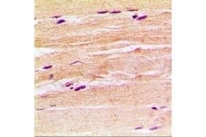 Immunohistochemical analysis of CGRP2 staining in rat heart formalin fixed paraffin embedded tissue section. (CALCB antibody)
