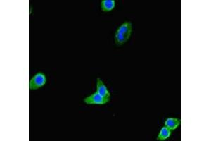 Immunofluorescent analysis of HepG2 cells using ABIN7172313 at dilution of 1:100 and Alexa Fluor 488-congugated AffiniPure Goat Anti-Rabbit IgG(H+L) (TOX3 antibody  (AA 8-305))