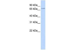 SLC5A5 antibody used at 1 ug/ml to detect target protein. (SLC5A5 antibody)