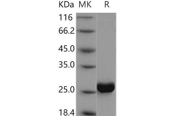 Cytidine Monophosphate (UMP-CMP) Kinase 1, Cytosolic (CMPK1) protein (His tag)