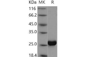Western Blotting (WB) image for Cytidine Monophosphate (UMP-CMP) Kinase 1, Cytosolic (CMPK1) protein (His tag) (ABIN7195354) (Cytidine Monophosphate (UMP-CMP) Kinase 1, Cytosolic (CMPK1) protein (His tag))