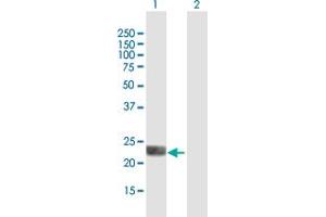 Western Blot analysis of LOH12CR1 expression in transfected 293T cell line by LOH12CR1 MaxPab polyclonal antibody.