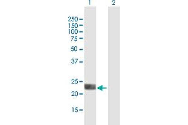 LOH12CR1 antibody  (AA 1-196)