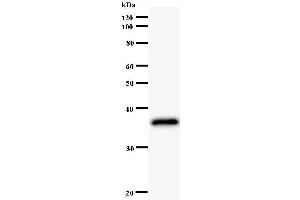 Western Blotting (WB) image for anti-LIM Homeobox 2 (LHX2) antibody (ABIN930948) (LHX2 antibody)