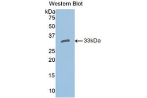 Western Blotting (WB) image for anti-Carbonic Anhydrase II (CA2) (AA 1-260) antibody (ABIN2116673) (CA2 antibody  (AA 1-260))