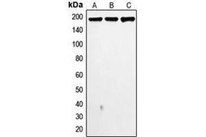 Western blot analysis of Topoisomerase 2 alpha expression in MDAMB468 (A), MDAMB231 (B), HeLa (C) whole cell lysates. (Topoisomerase II alpha antibody  (N-Term))