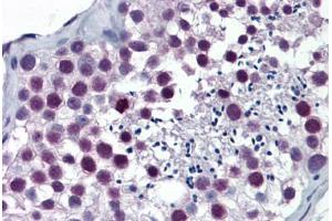 Human Testis: Formalin-Fixed, Paraffin-Embedded (FFPE) (ARNT antibody  (AA 1-110))