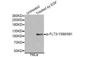 Western blot analysis of extracts of various cell lines, using Phospho-FLT3-Y589/591 antibody. (FLT3 antibody  (pTyr589, pTyr591))
