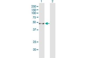 Western Blot analysis of WDR41 expression in transfected 293T cell line by WDR41 polyclonal antibody (A01). (WDR41 antibody  (AA 1-459))