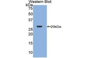 Western Blotting (WB) image for anti-Neurofibromin 2 (NF2) (AA 30-239) antibody (ABIN1859996) (Merlin antibody  (AA 30-239))