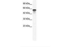 Image no. 1 for anti-Zinc Finger Protein 230 (ZNF230) (AA 133-182) antibody (ABIN6735984) (ZNF230 antibody  (AA 133-182))