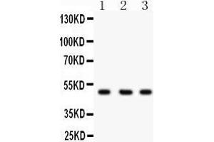 Western Blotting (WB) image for anti-C-terminal Binding Protein 2 (CTBP2) (AA 321-445) antibody (ABIN3042768) (CTBP2 antibody  (AA 321-445))