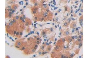 Immunohistochemistry (IHC) image for anti-DEAD (Asp-Glu-Ala-Asp) Box Polypeptide 58 (DDX58) (AA 550-776) antibody (ABIN7433744)