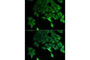 Immunofluorescence analysis of U2OS cell using TSC22D3 antibody.