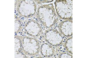 Immunohistochemistry of paraffin-embedded human stomach using BCL2L2 antibody (ABIN5970504) at dilution of 1/100 (40x lens). (BCL2L2 antibody)