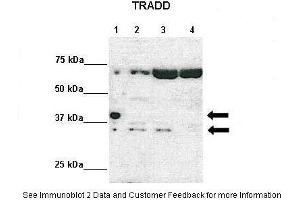 Lanes:   Lane 1: 10ug Tradd-HA-Strep-stable expression 293TREXFlpIn cells-Doxycycline induced Lane 2: 10ug ITradd-HA-Strep-stable expression 293TREXFlpIn cells-non-induced Lane 3: 10ug siRNA scrambled-MDA-MB-231 cells Lane 4: siRNA Tradd-MDA-MB-231 cells  Primary Antibody Dilution:    1:1000  Secondary Antibody:   Anti-rabbit HRP  Secondary Antibody Dilution:    1:2000  Gene Name:   TRADD  Submitted by:   Dr.