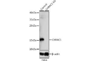 Western blot analysis of extracts from normal (control) and CHR knockout (KO) HeLa cells, using CHR antibody (ABIN7266355) at 1:1000 dilution.