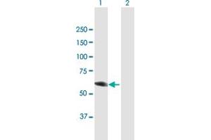 Western Blot analysis of DPYSL3 expression in transfected 293T cell line by DPYSL3 MaxPab polyclonal antibody. (DPYSL3 antibody  (AA 1-570))