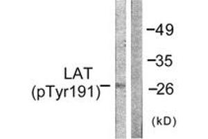 Western blot analysis of extracts from NIH-3T3 cells, using LAT (Phospho-Tyr191) Antibody. (LAT antibody  (pTyr191))