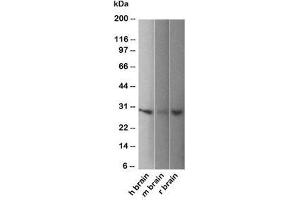 Western blot of human, mouse and rat brain lysate using PGP9. (UCHL1 antibody)